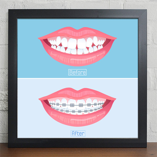 디자인 벽면 인테리어 소품 벽걸이 치과 치아 의사 양치 칫솔 충치 교정 건강 일러스트 미백 cv118-건강한치아관리 인테리어액자